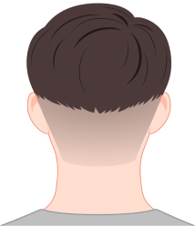 한나이브비절개채취,투블럭컷