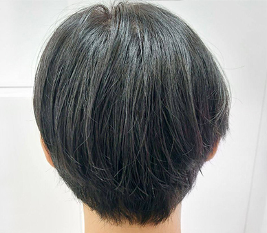 술후