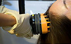 한나이브이식후관리,두피마사지