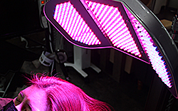 한나이브이식후관리,열적외선광선치료