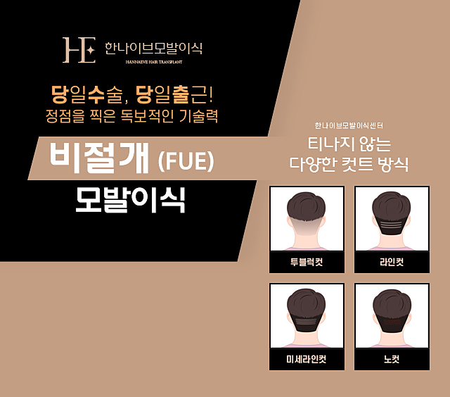 비절개모발이식