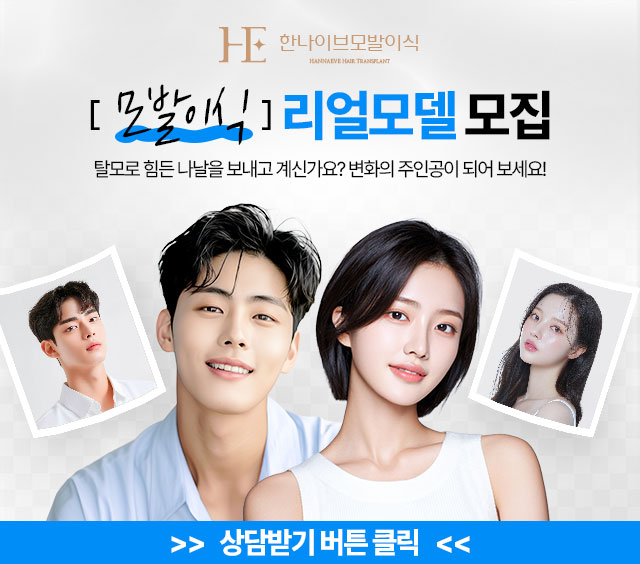 모발이식리얼모델모집